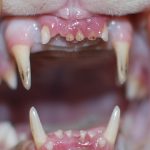 Tooth wear and fractures